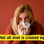 What Your Snot Color Can Reveal About Your Health—And When You Should Be Concerned